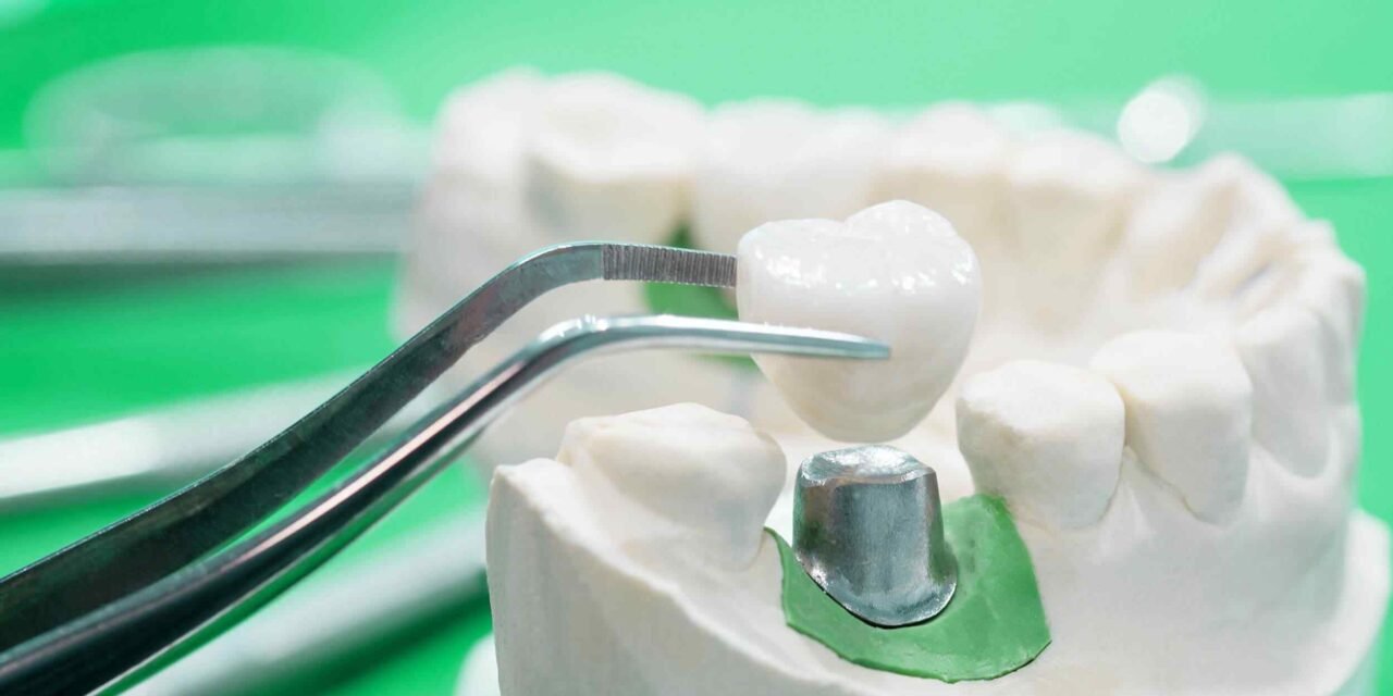 https://dentivoyage.com/wp-content/uploads/2020/01/post-28-1280x640.jpg